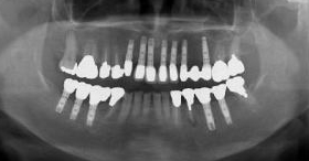 �C���v�����g�p�ヌ���g�Q��