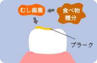 �v���[�N�i���C�j